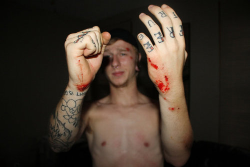 bloody hands